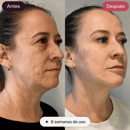 Dermova · Dispositivo de Lifting Facial Microcorriente + Gel Conductor 50ml