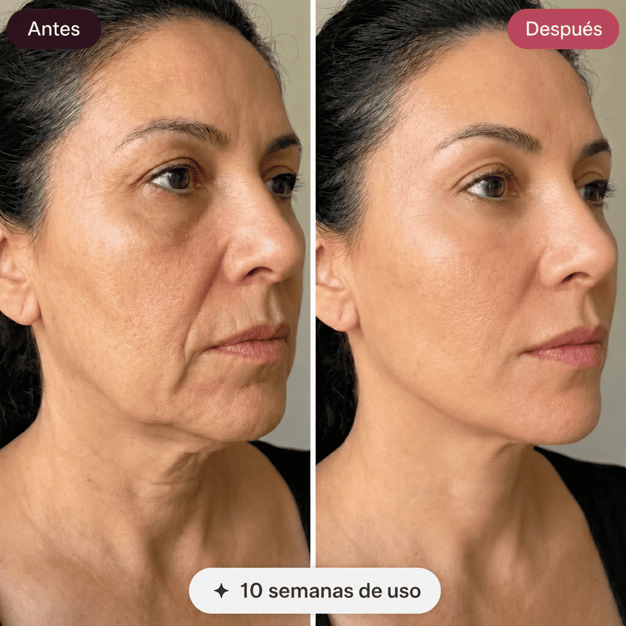 Dermova · Dispositivo de Lifting Facial Microcorriente + Gel Conductor 50ml