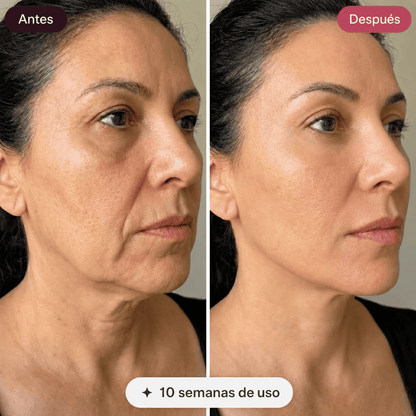 Dermova · Dispositivo de Lifting Facial Microcorriente + Gel Conductor 50ml